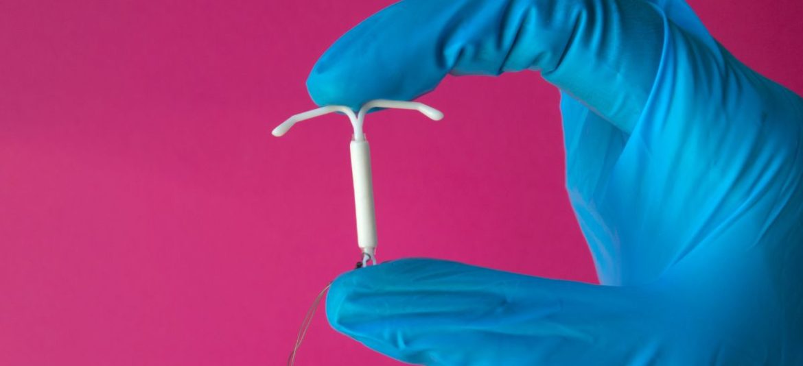 DIU tudo o que precisa saber